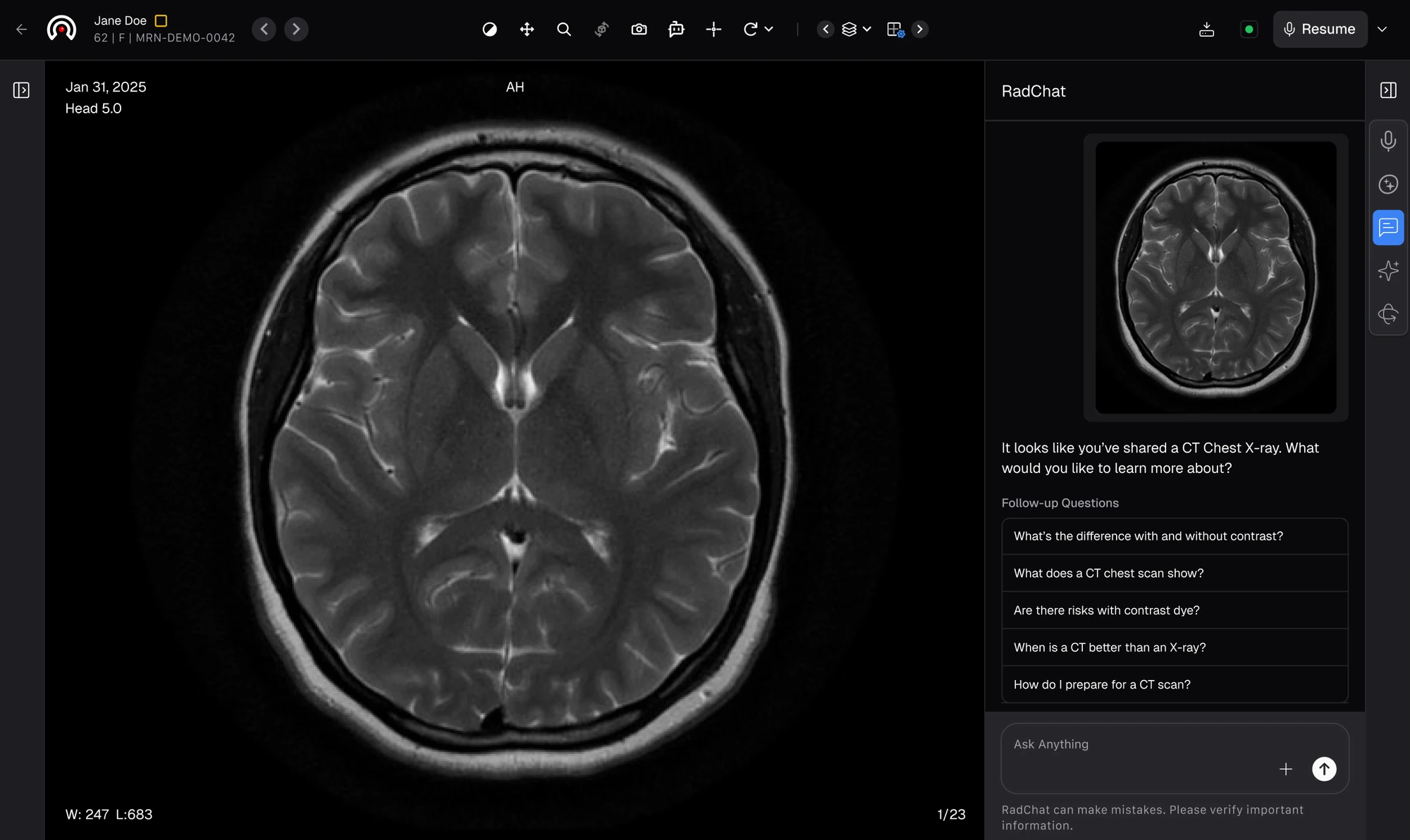RadioView.AI RadChat: a conversational assistant answering follow-up questions about the current study, grounded in the imaging and the patient history