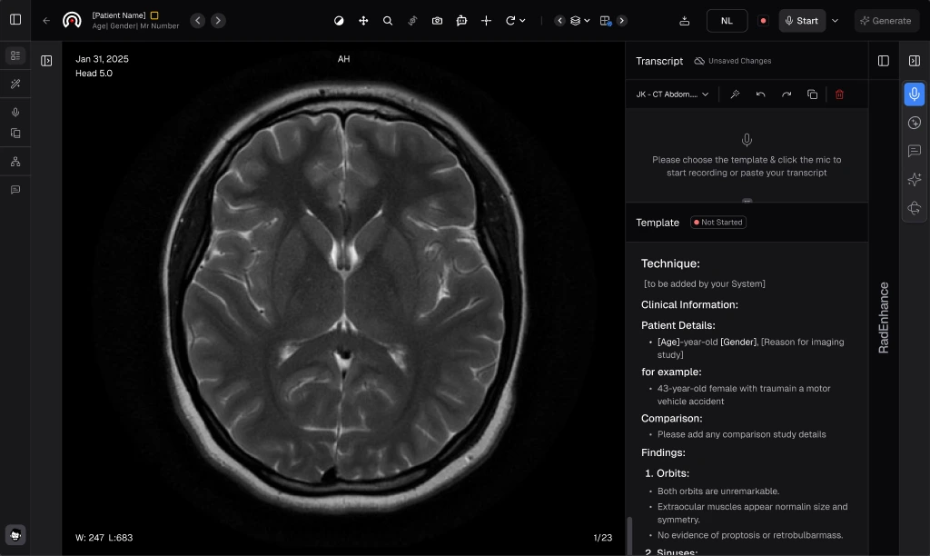 ARRG generates a structured radiology report from a CT scan